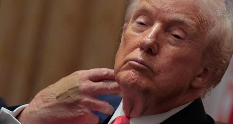 Casa Branca atribui curativo na mão de Trump ao excesso de apertos de mão